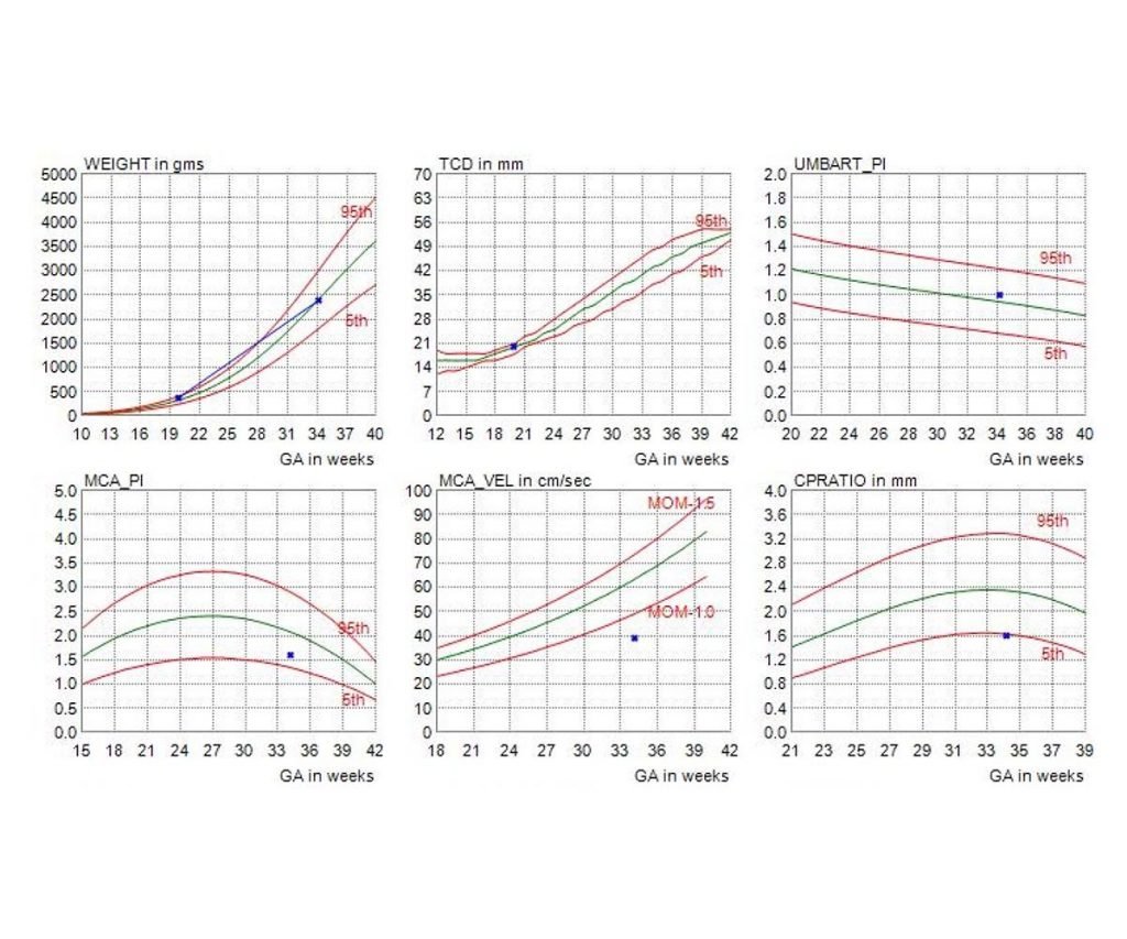 Growth Scan Chart