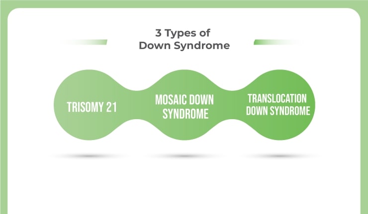 Types Of Down Syndrome