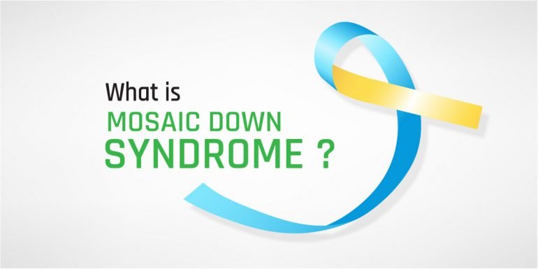 Mosaic Down Syndrome Causes Symptoms Diagnosis And Treatment 6062