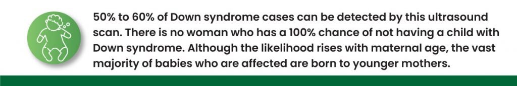 50% to 60% of Down syndrome cases can be detected by this ultrasound scan