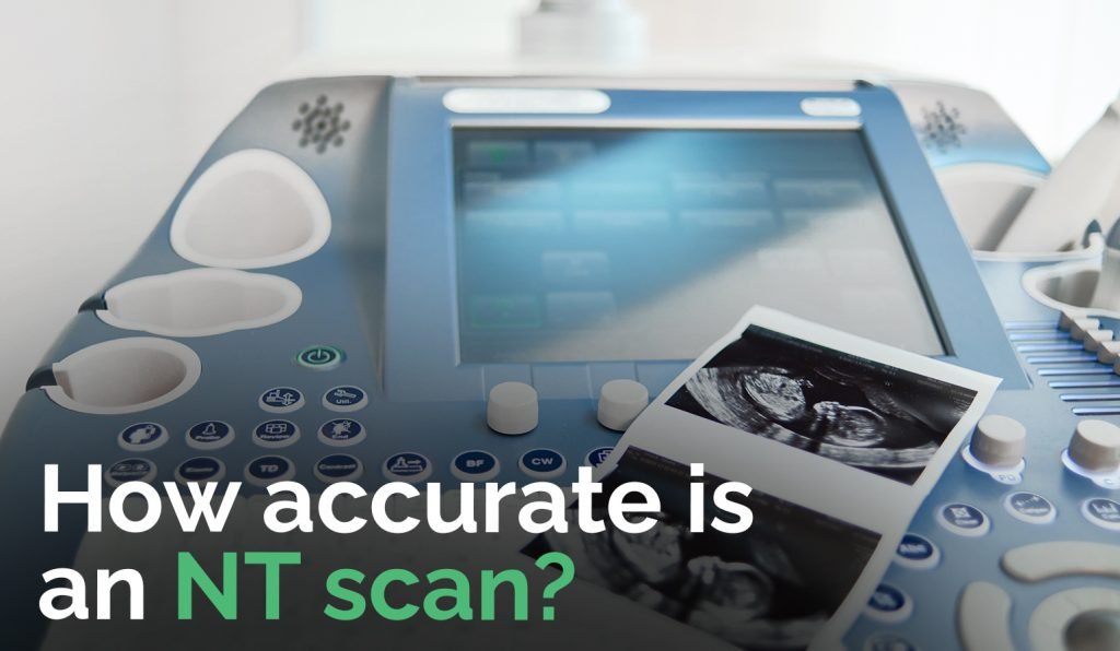 How accurate is an NT scan (3)