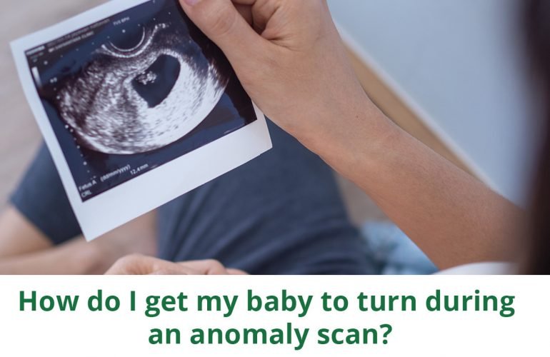 How do I get my baby to turn during an anomaly scan