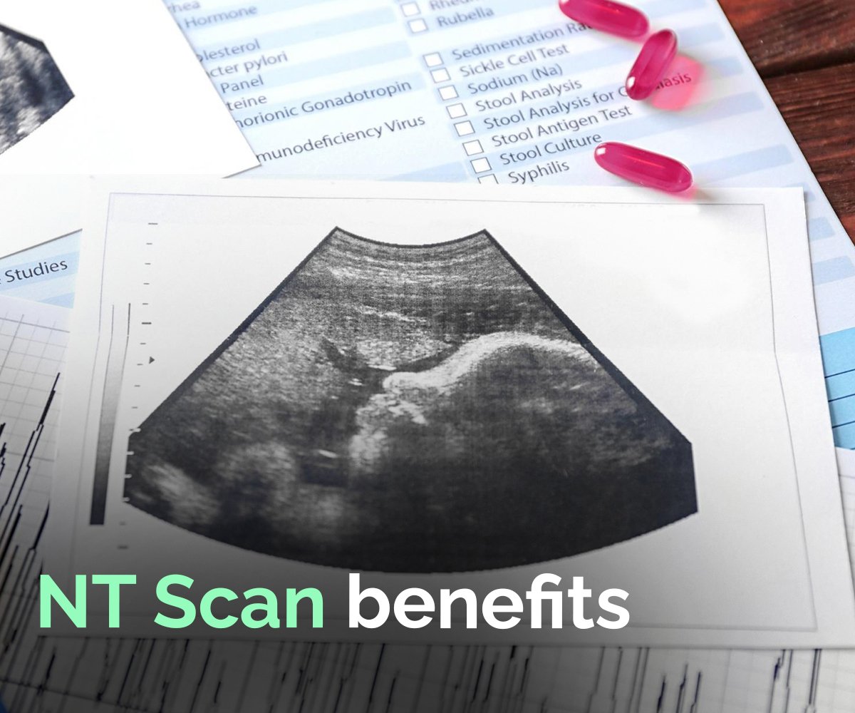 nt scan benefits