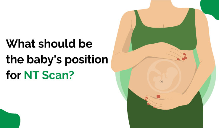 What should be the baby's position for NT Scan