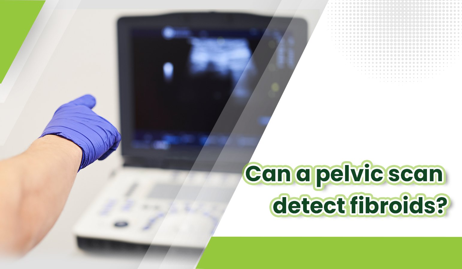 can a pelvic scan detect fibroids