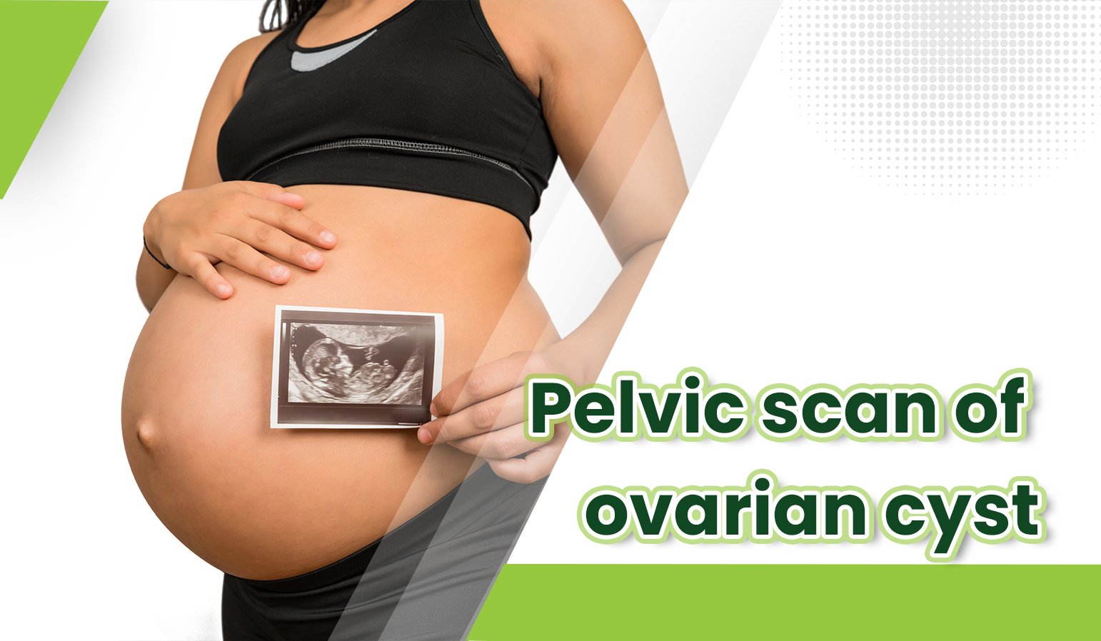 pelvic scan of ovarian cyst