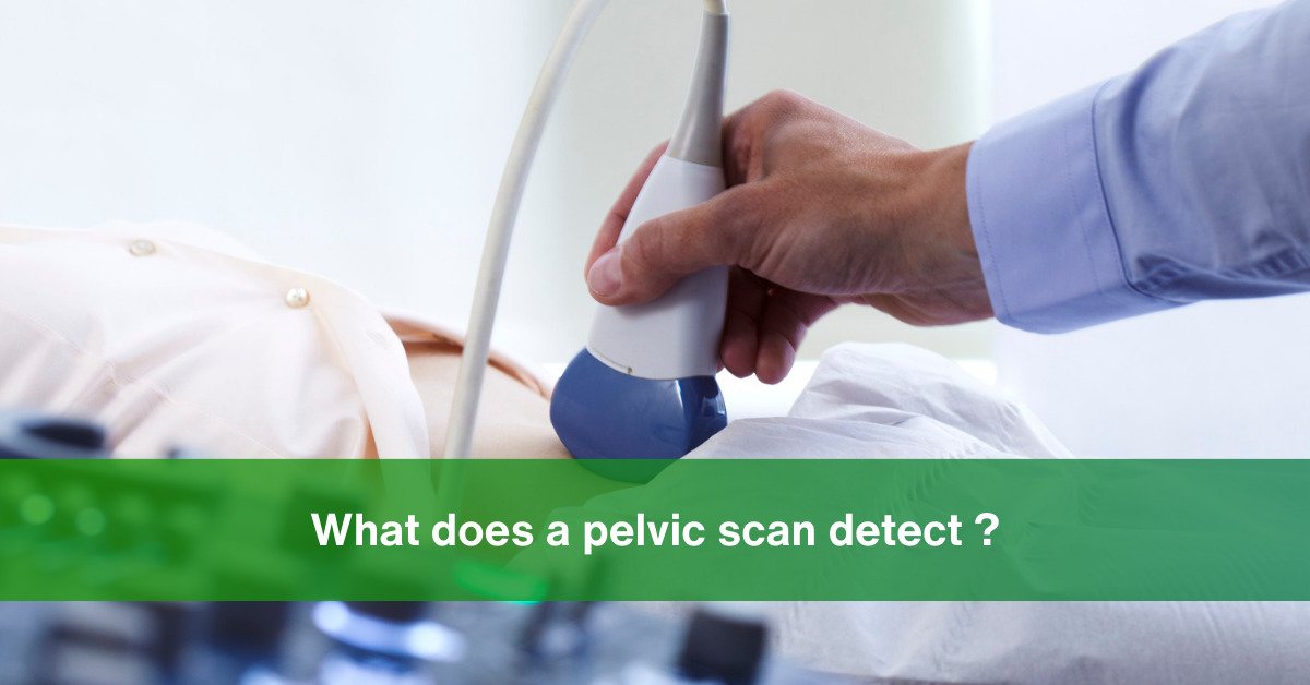 what does pelvic scan detect