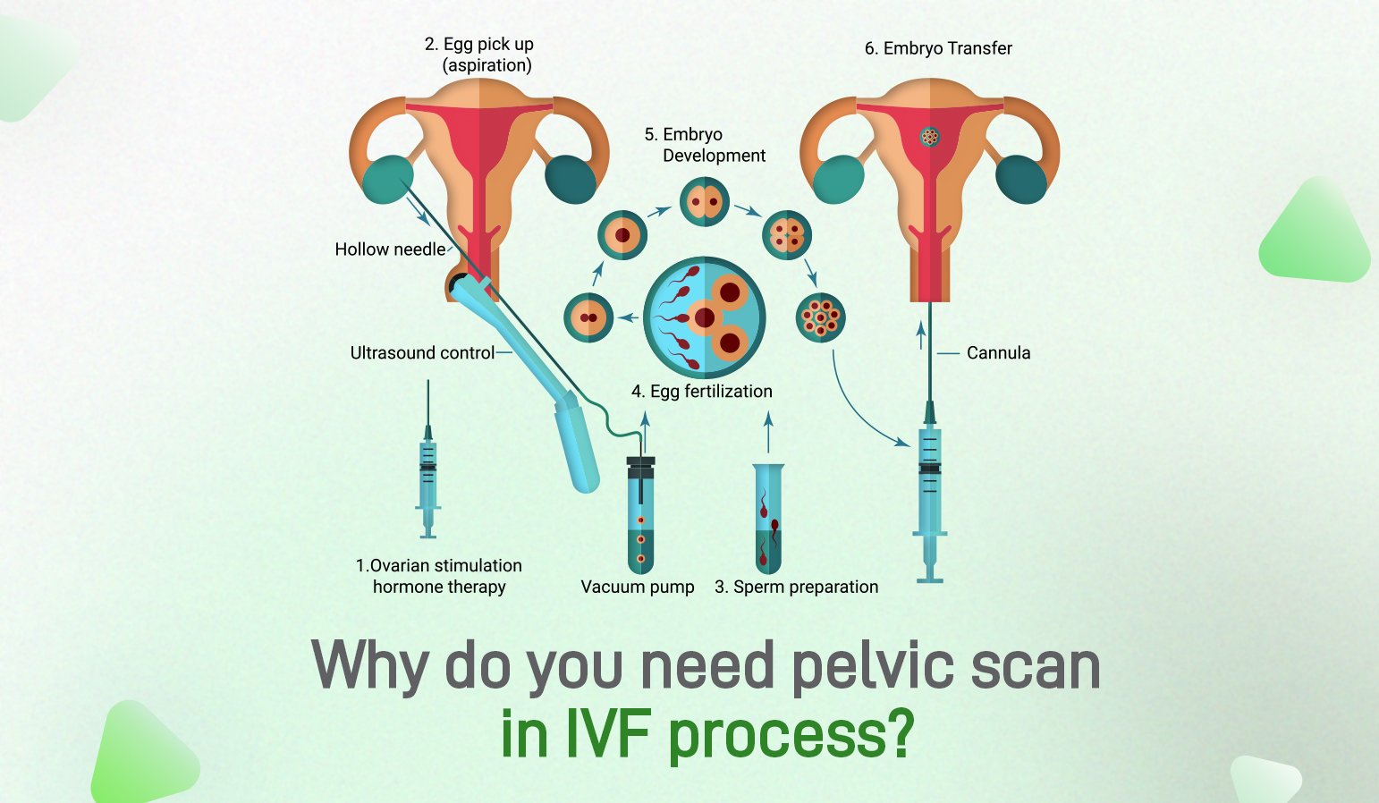 why do you need pelvic scan in ivf process