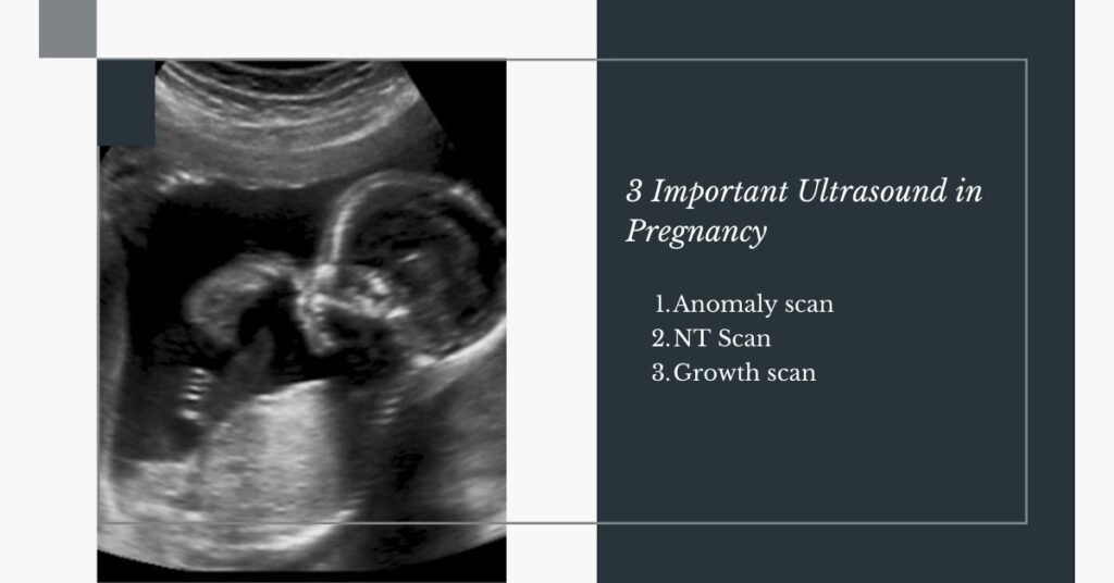 3 important ultrasound in pregnancy