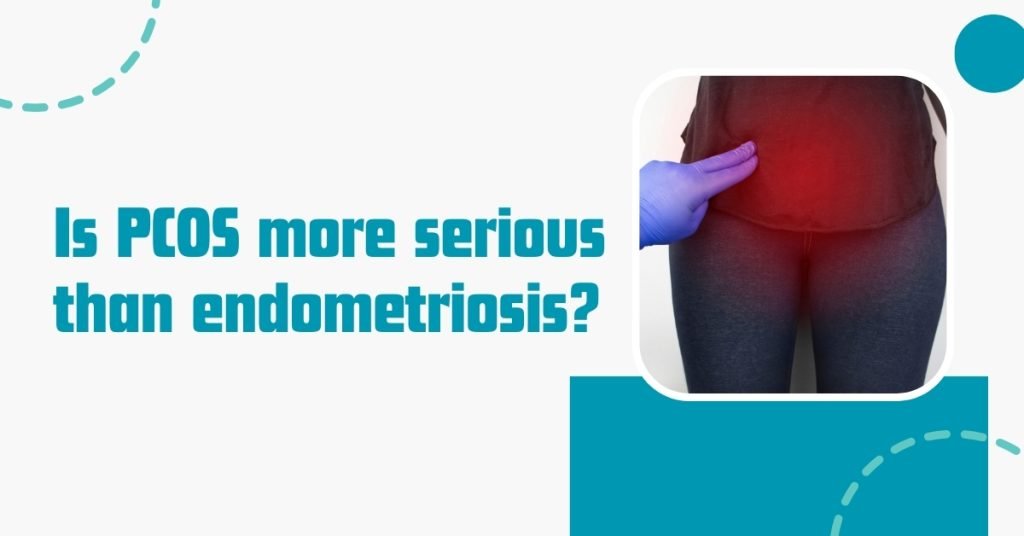 is pcos more serious than endometriosis