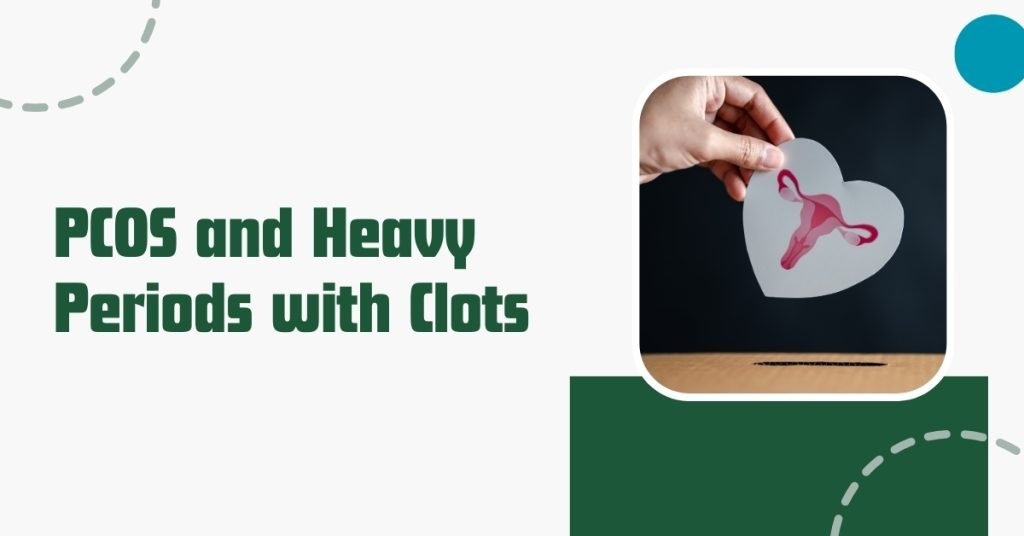 pcos and heavy periods with clots