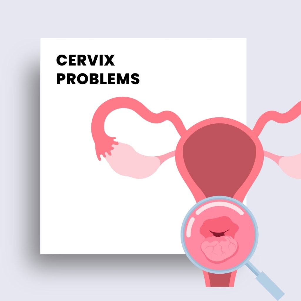 cervix problems