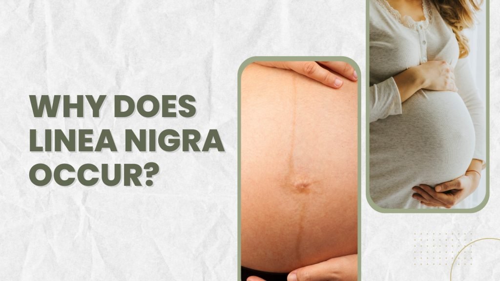 why does linea nigra occur