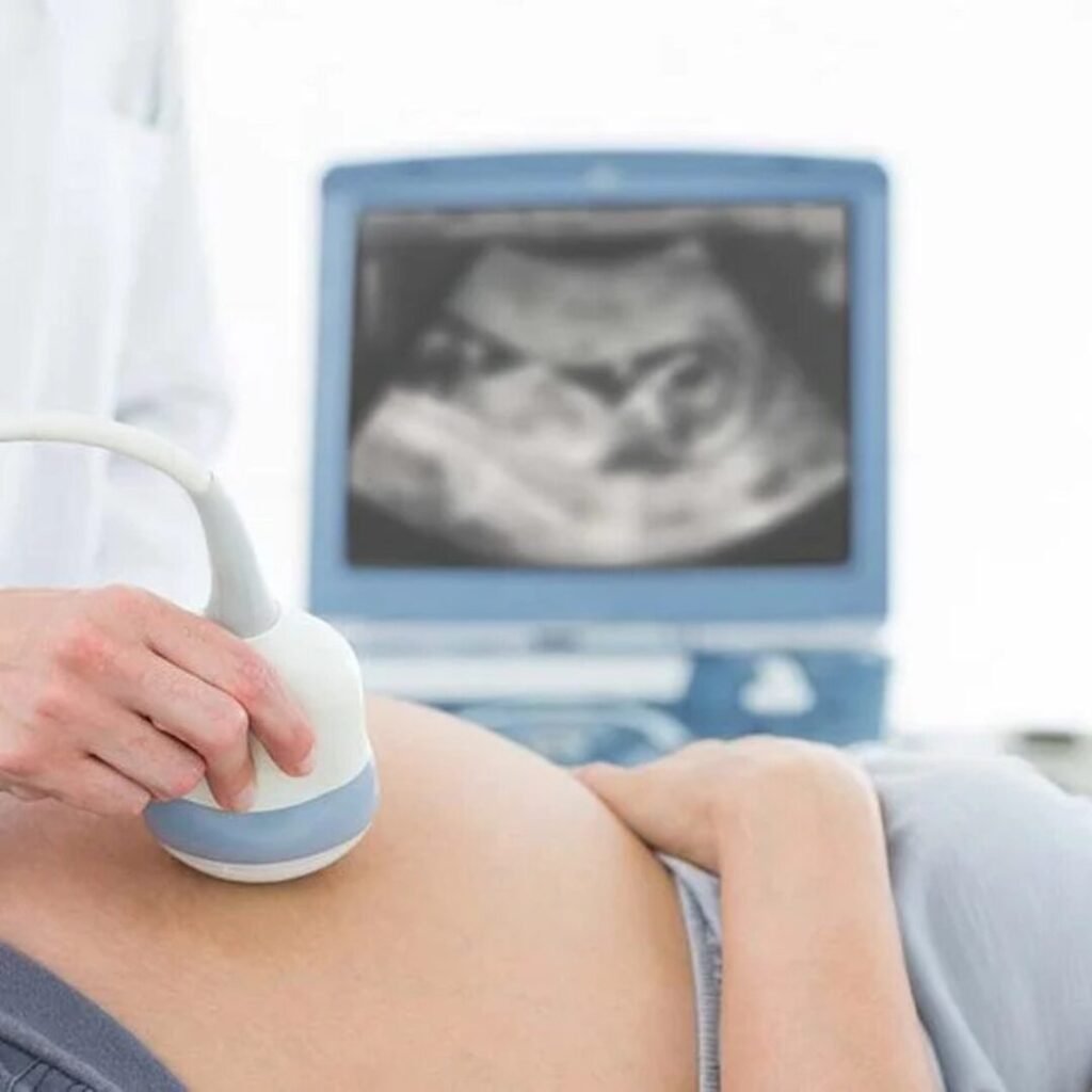 NT Scans And Prenatal Screening image