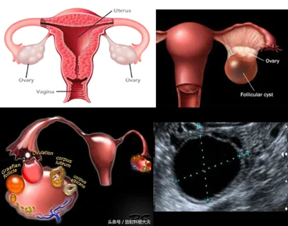 follicular-study