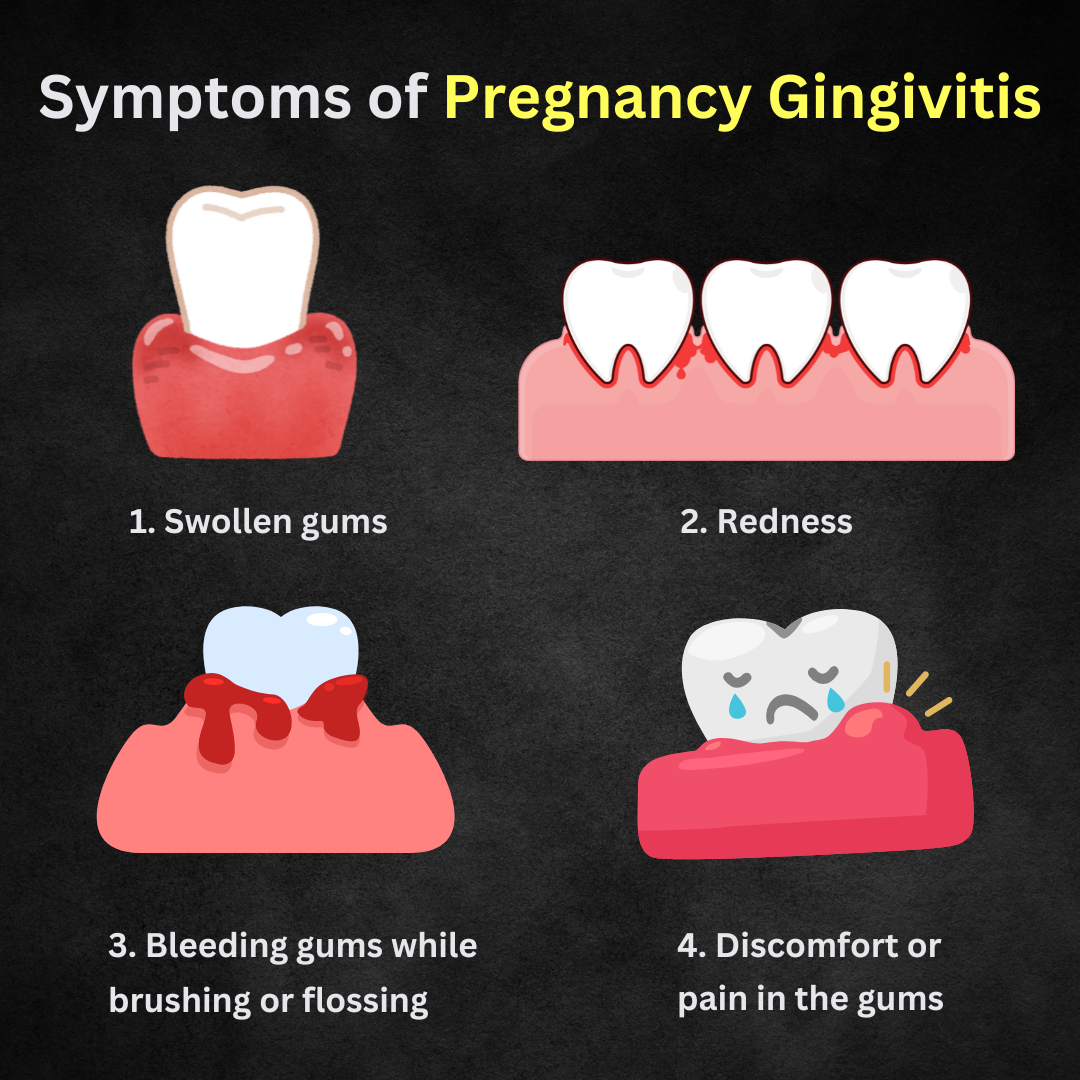 Symptoms of Pregnancy Gingivitis Symptoms of Pregnancy Gingivitis