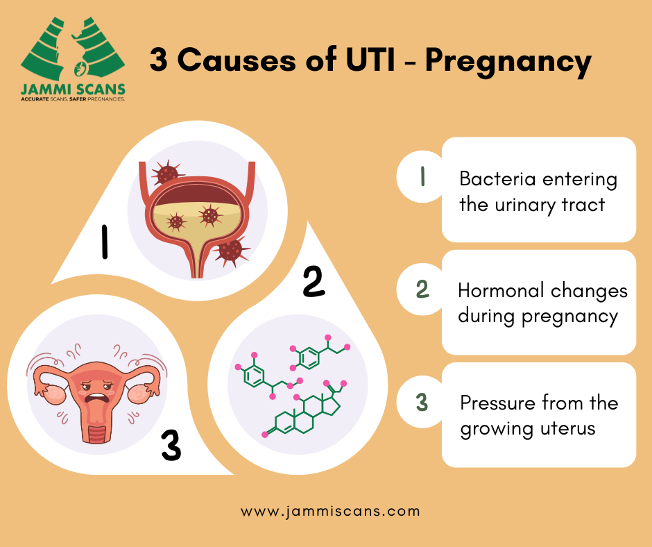 3 Causes of UTI Pregnancy