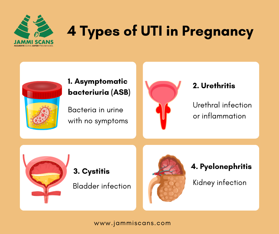 4 Types of UTI in Pregnancy